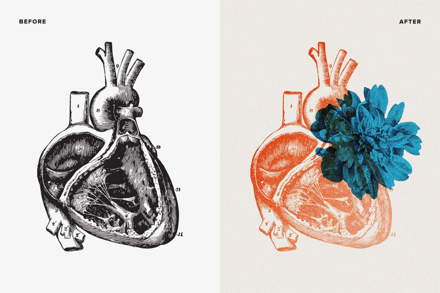 Vintage anatomical heart illustration before and after showing transformation with overlay of blue floral design perfect for graphic design projects and templates.