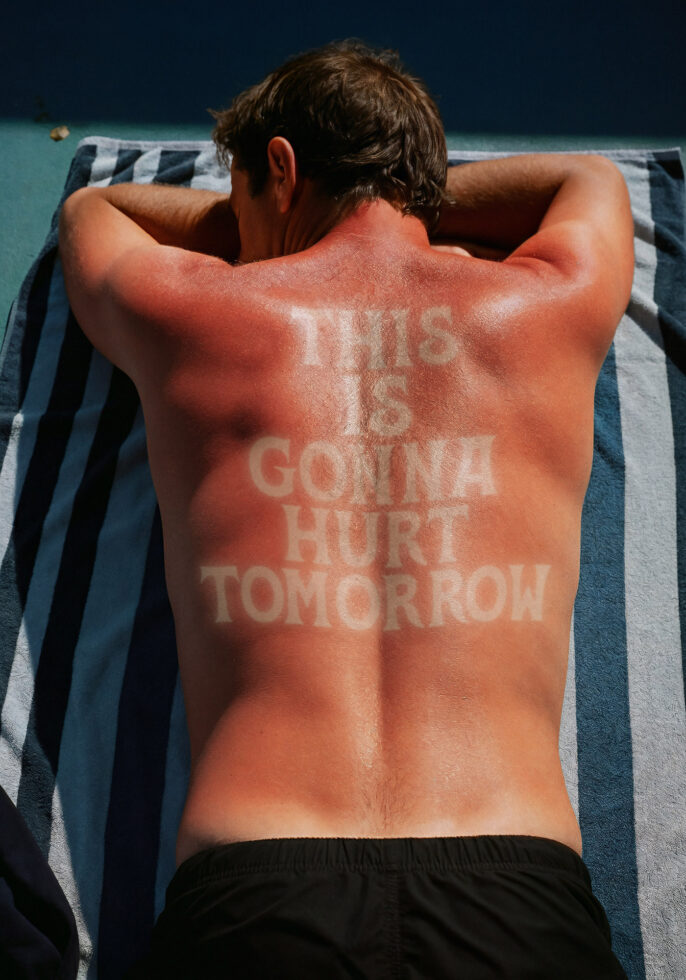 Man with sunburned back displaying text this is gonna hurt tomorrow humorous summer mockup design concept for designers beach towel background.