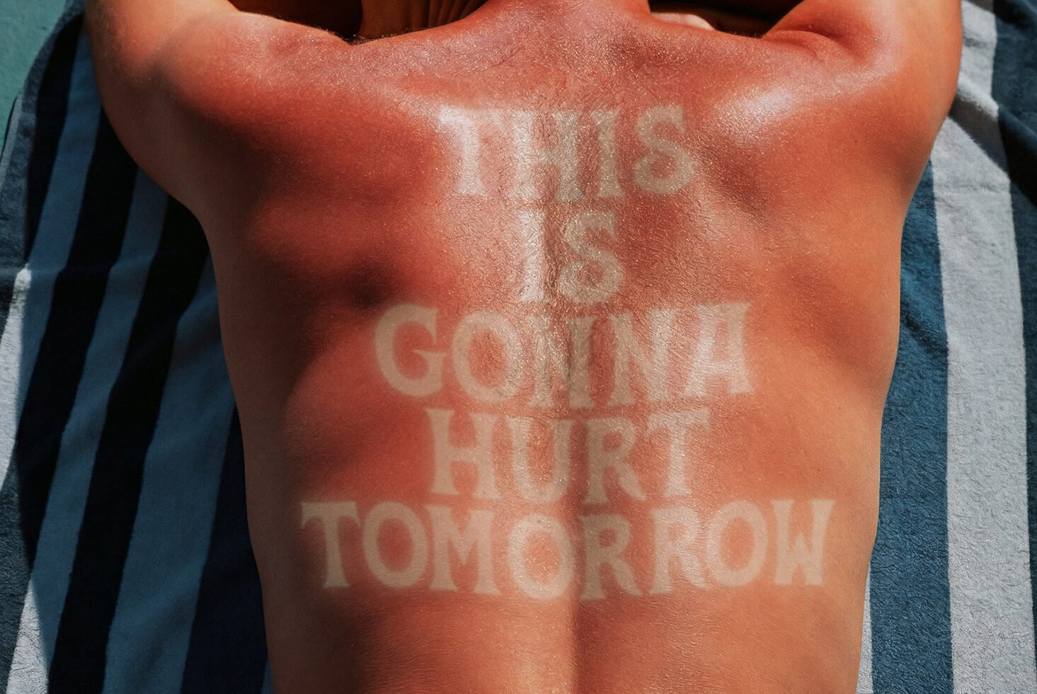 Sunburned back with text tan lines saying This is gonna hurt tomorrow on beach towel. Perfect for graphic design projects, summer-themed artwork, typography.