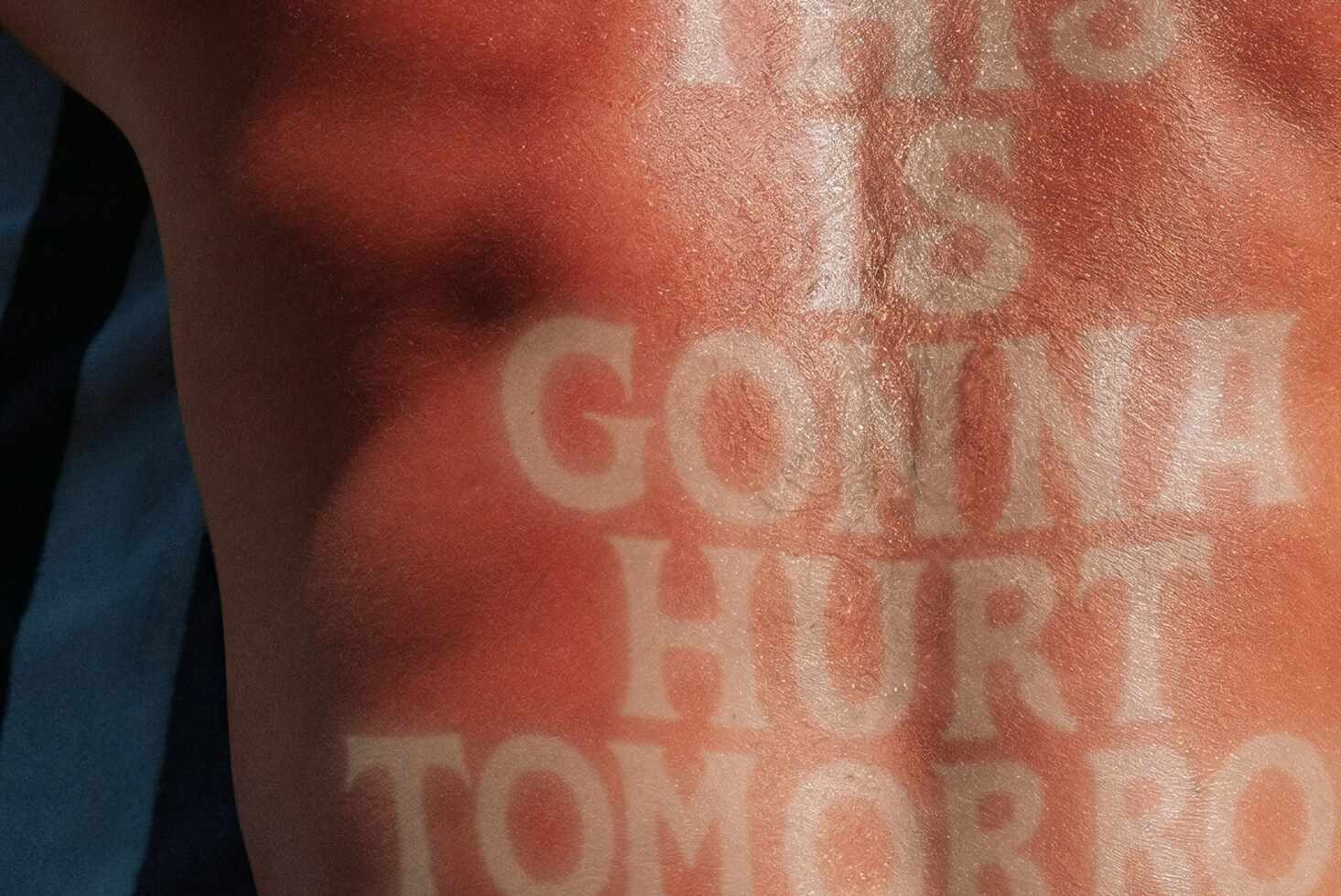 Sunburned skin with bold typography, text reading this is gonna hurt tomorrow, perfect for graphic design mockups and typography projects.