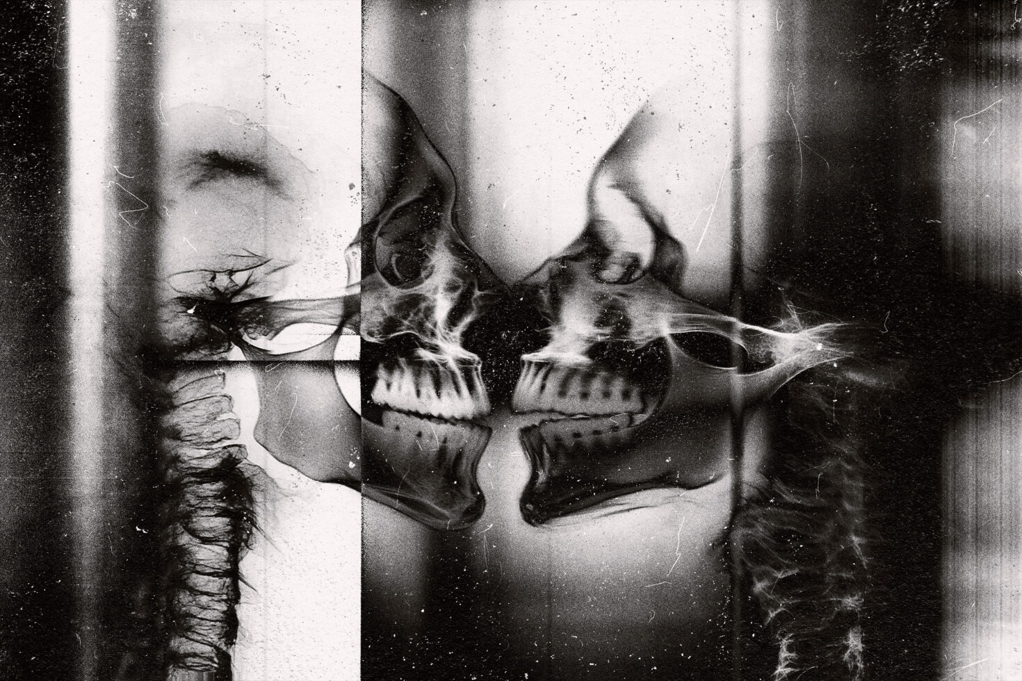 Distressed black white X-ray style anatomical skull image split with light leaks damaged film effect